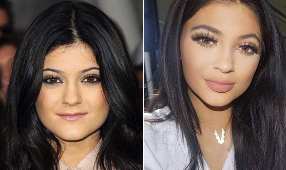 kylie-jenner-antes-depois